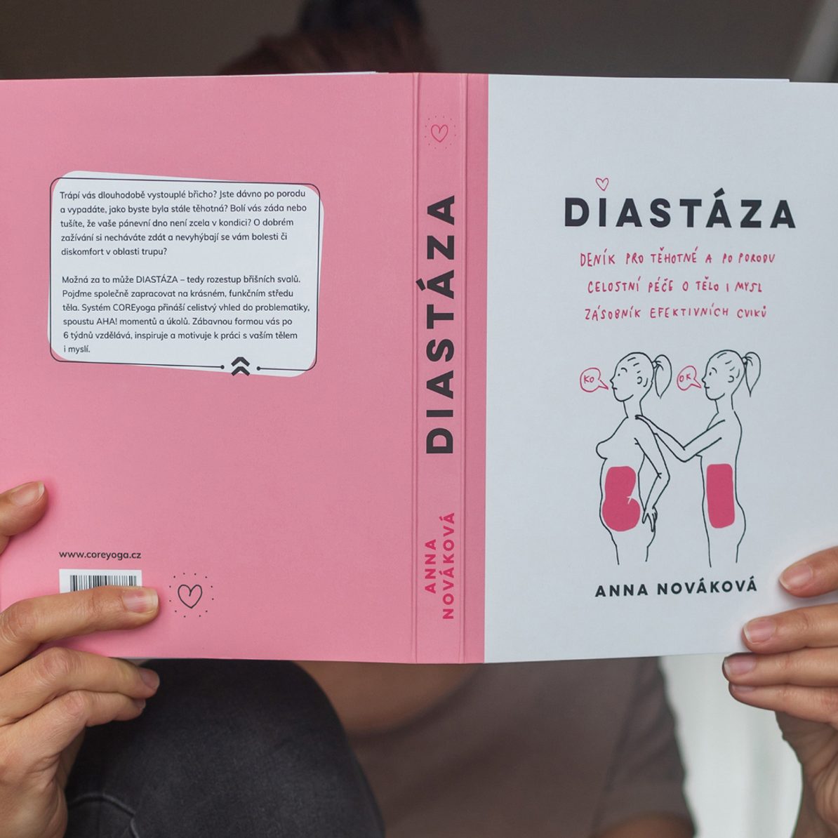 Diastasis recti – a separation of the abdominal muscles can affect anyone, not just women after childbirth