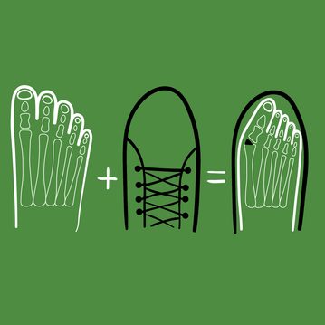 2/4 Hallux valgus? Die richtigen Schuhe können dein Leben verändern. So findest du sie