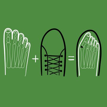 2/4 Hallux valgus? Správná obuv vám může změnit život. Zjistěte, jak ji vybrat