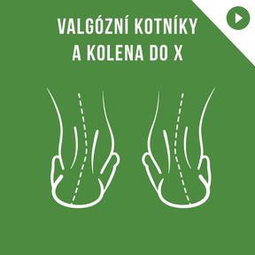 PODCAST: Bc. Edita Prošková: Valgusknöchel und X-Beine