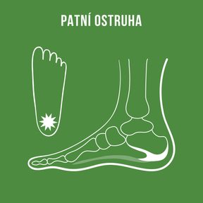 Zažívejte opět radost z bezbolestné chůze – s patní ostruhou vám pomůže i fyzioterapeut
