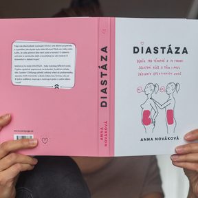 Diastase – eine Bauchmuskeltrennung kann jede*n betreffen, nicht nur Frauen nach der Geburt