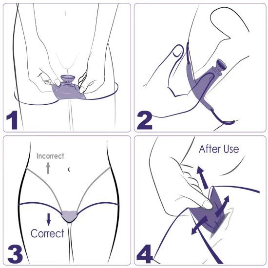 EXS Non-Latex Internal