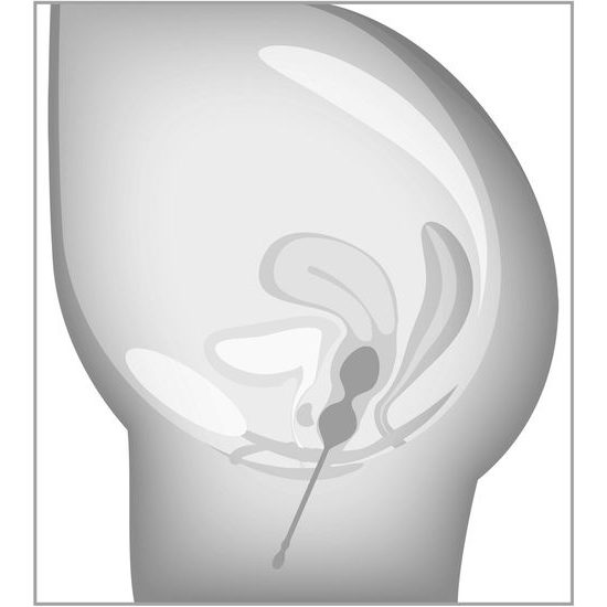 beau coeur Elorin komplet ljubezenskih kroglic